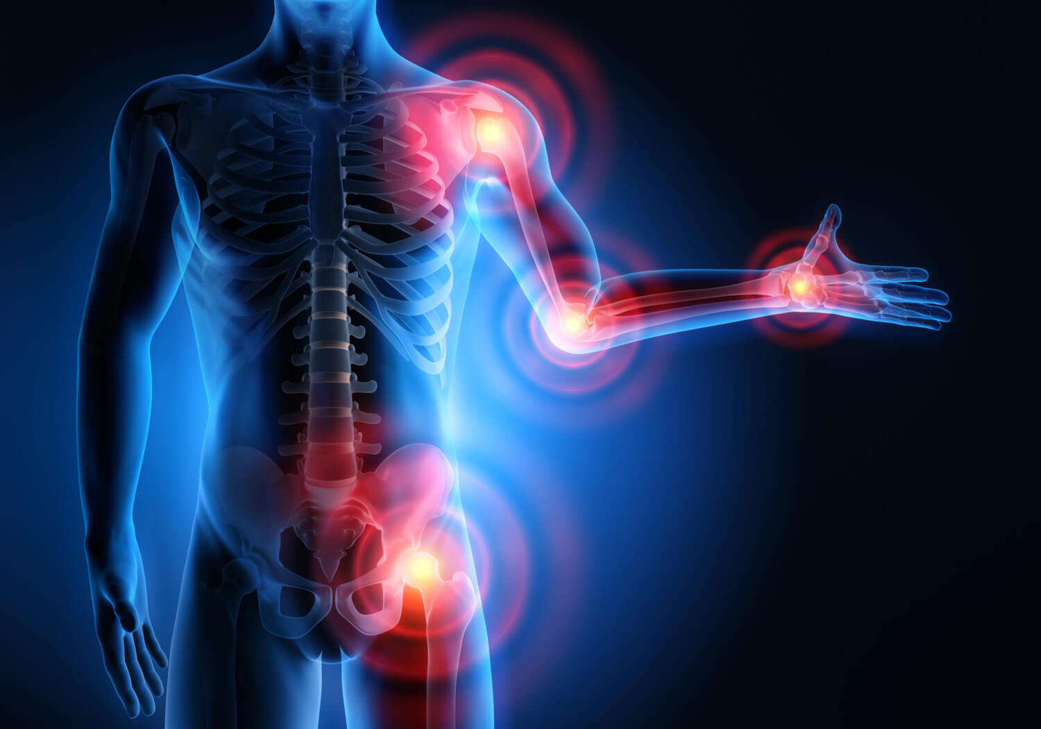 Die Vorteile von Yoga für Menschen mit Arthritis